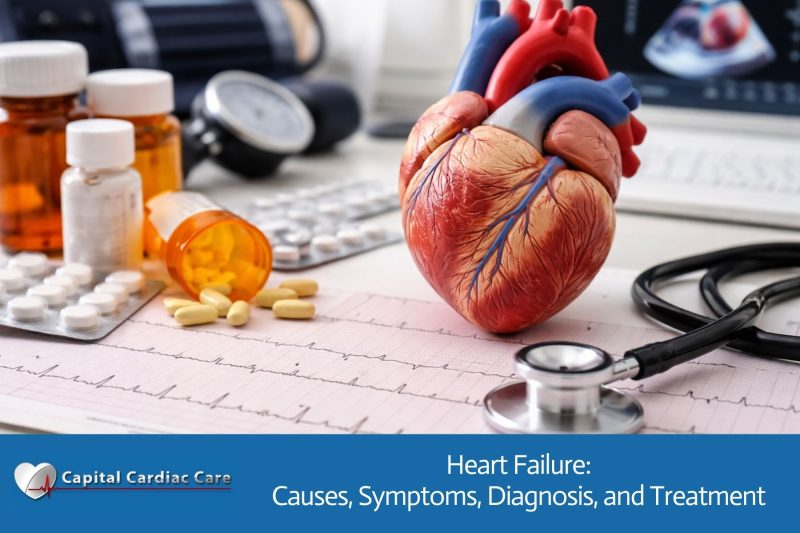 Heart Failure: Causes, Symptoms, Diagnosis, and Treatment