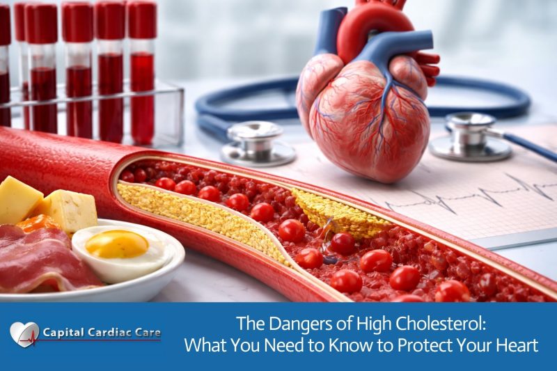 The Dangers of High Cholesterol: What You Need to Know to Protect Your Heart